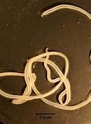 Image result for Dracunculus Nematode