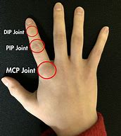 Image result for Index Finger First Joint Swelling