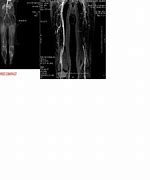 Image result for MRI Angio Full Body