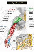 Image result for Brachial Plexus Innervation Chart