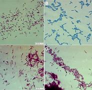 Image result for Mycobacterium GM's Stain