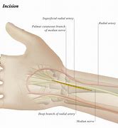 Image result for Volar Aspect Finger