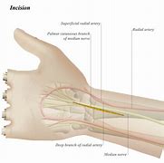 Image result for Volar and Dorsal Hand