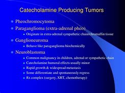 Image result for Pheochromocytoma Presentation