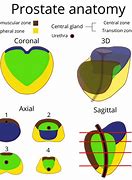 Image result for Prostate Gland Structure