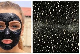 Image result for Blackhead Removal Peel Off Mask