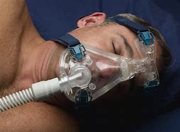 Image result for Sleep Apnea Surgery