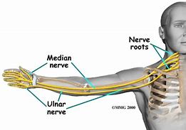 Image result for Median Nerve Distribution Arm