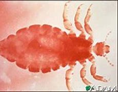 Image result for Rabbit Lice