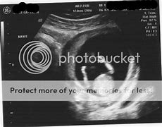 Image result for 13 Week Baby Ultrasound