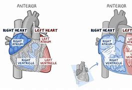 Image result for Interatrial Septum Formation