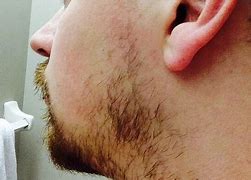 Image result for Weak Cheek Beard