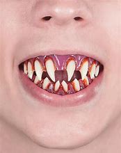 Image result for Clown Teeth