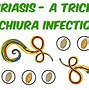 Image result for Trichiniasis