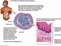 Image result for Relations of Esophagus