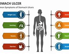 Image result for What Are Stomach Ulcers