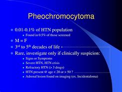 Image result for Pheochromocytoma Presentation