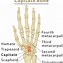 Image result for Capitate Bone Pain