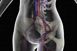 Image result for Femoral Blood Clot