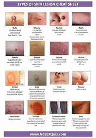 Image result for Skin Rash Identification Chart