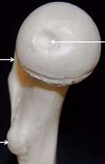 Image result for Femur Osteology