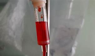 Image result for Red Chapstick Medcine