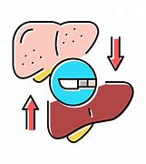 Image result for Liver Transplant Clip Art