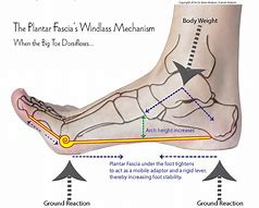 Image result for Medial Plantar Fascia