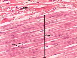 Image result for Micro Tears in Muscle Fiber Under Microscopes