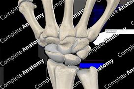 Image result for hamate bone x-ray