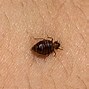 Image result for Bed Bug Bites Row