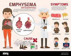 Image result for Chronic Emphysema