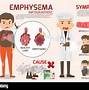 Image result for Emphysema