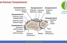 Image result for Extensor Tendon Hand Wrist Brace