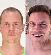 Image result for Marc-Andre Ter Stegen Long Hair