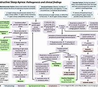 Image result for Obstructive Sleep Apnea and Hypertension