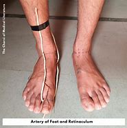 Image result for Arteria Dorsalis Pedis