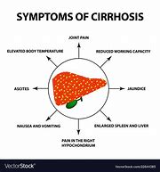 Image result for Early Symptoms Cirrhosis Liver