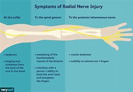 Image result for Radial Nerve in Hand