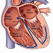 Image result for Atrioventricular Nodal Artery