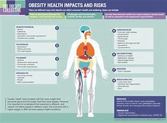 Image result for Obesity