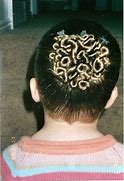 Image result for Build Up with Worms in Hair