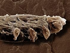 Image result for Mites Under Skin