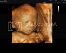 Image result for Mother 4D Baby Scan