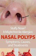 Image result for Swollen Inside Nose