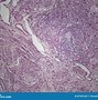 Image result for Uteres Histology