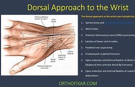 Image result for Dorsal Aspect Wrist