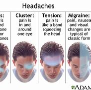 Image result for Headache Left Side of Head