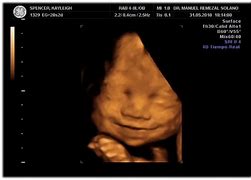 Image result for CT Baby Scan 3D