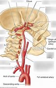 Image result for Internal Carotid Artery